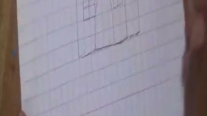 在进行牙齿美白之前，以下几点注意事项不容忽视：