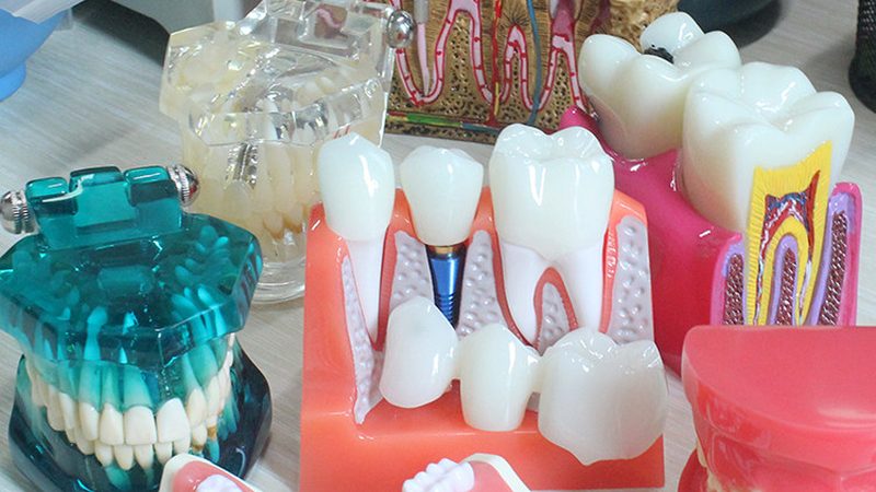 根管治疗：揭秘步骤与材料的选择**
