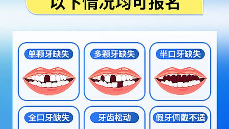 全口种植牙定制：流程解析与时间考量