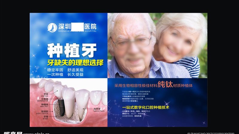 成都全瓷牙，如何挑选最适合自己的？**